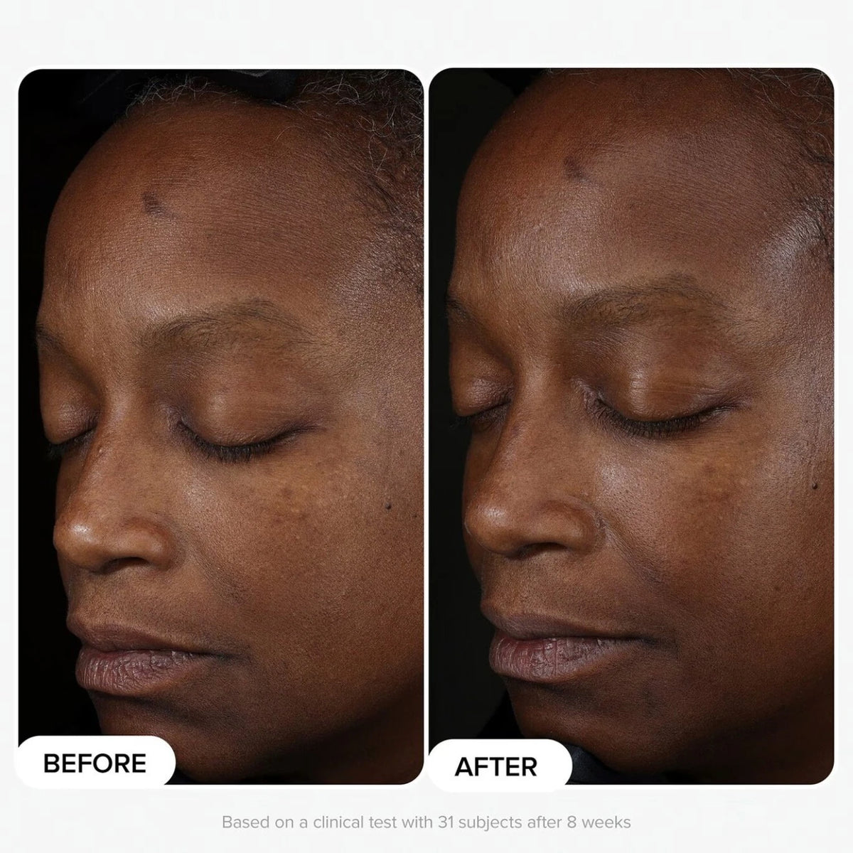 10% Niacinamide Booster - Azora Beauty