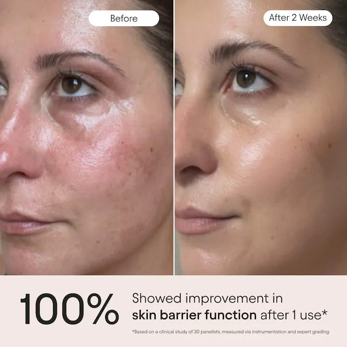 3-In-1 Barrier Repair Serum With Azelaic Acid For Hyperpigmentation, Firming & Redness Relief