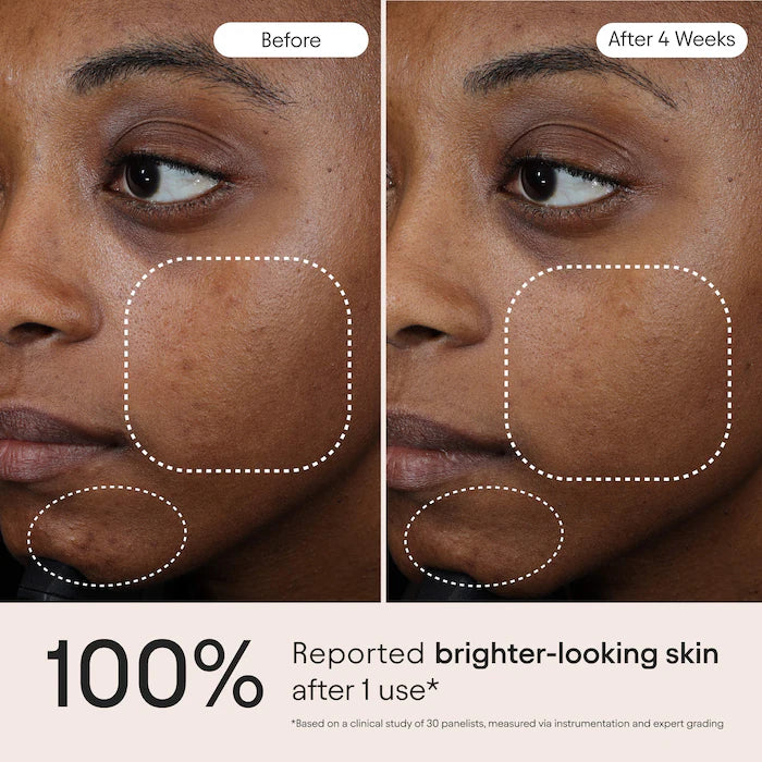 3-In-1 Barrier Repair Serum With Azelaic Acid For Hyperpigmentation, Firming & Redness Relief