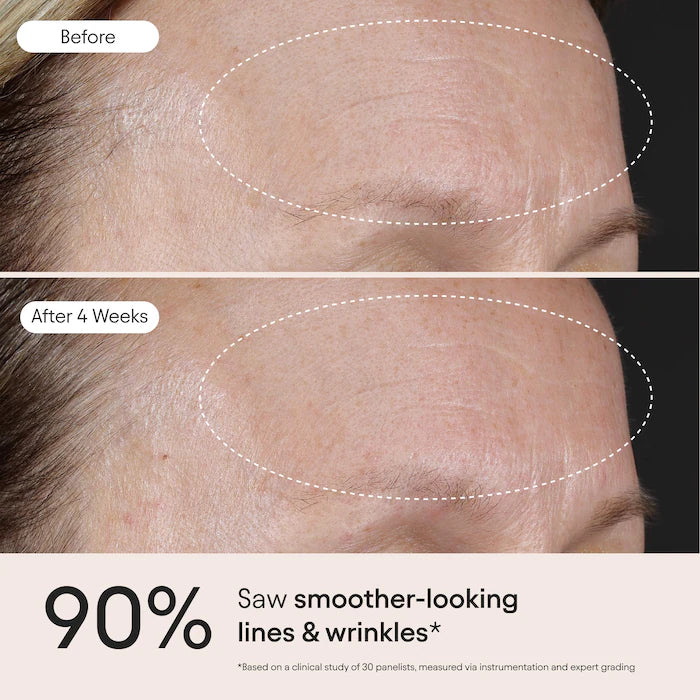 3-In-1 Barrier Repair Serum With Azelaic Acid For Hyperpigmentation, Firming & Redness Relief