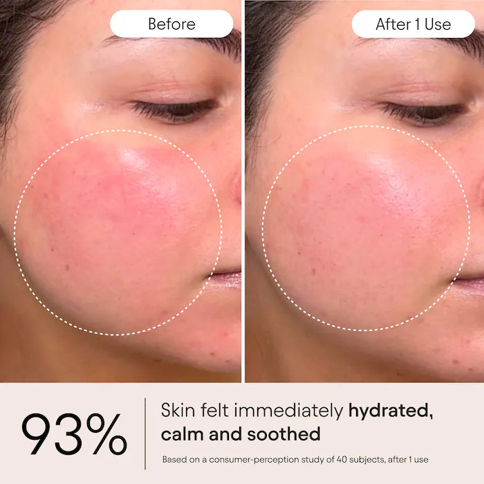 Super Peptide Barrier Repair Moisturizer For Eczema, Wrinkles, Firming & Sensitive Skin