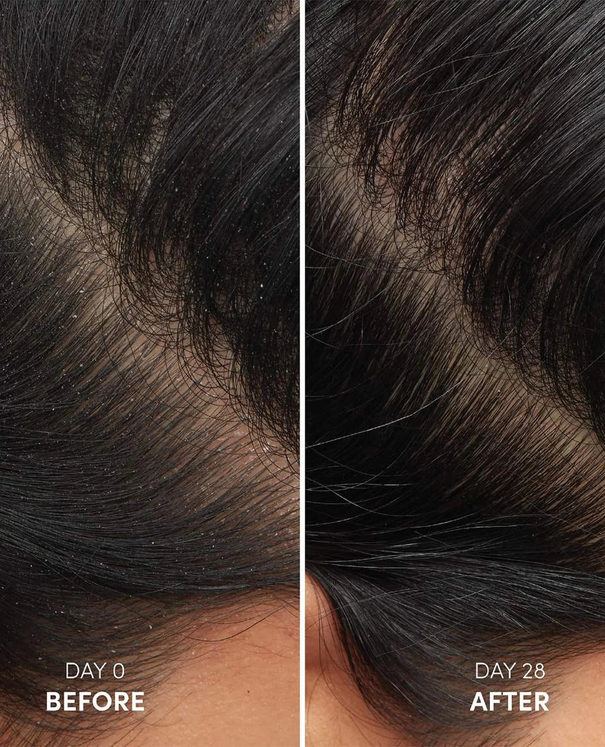 Anti-Dandruff Shampoo - Azora Beauty