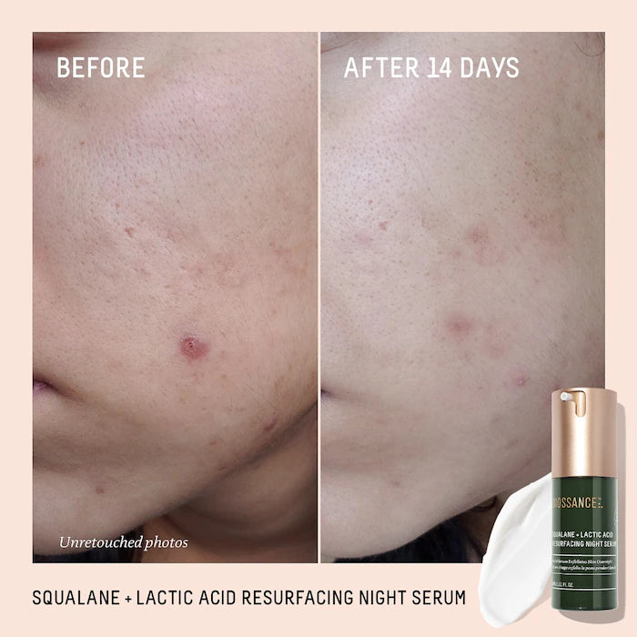 Squalane + 10% Lactic Acid Resurfacing Serum