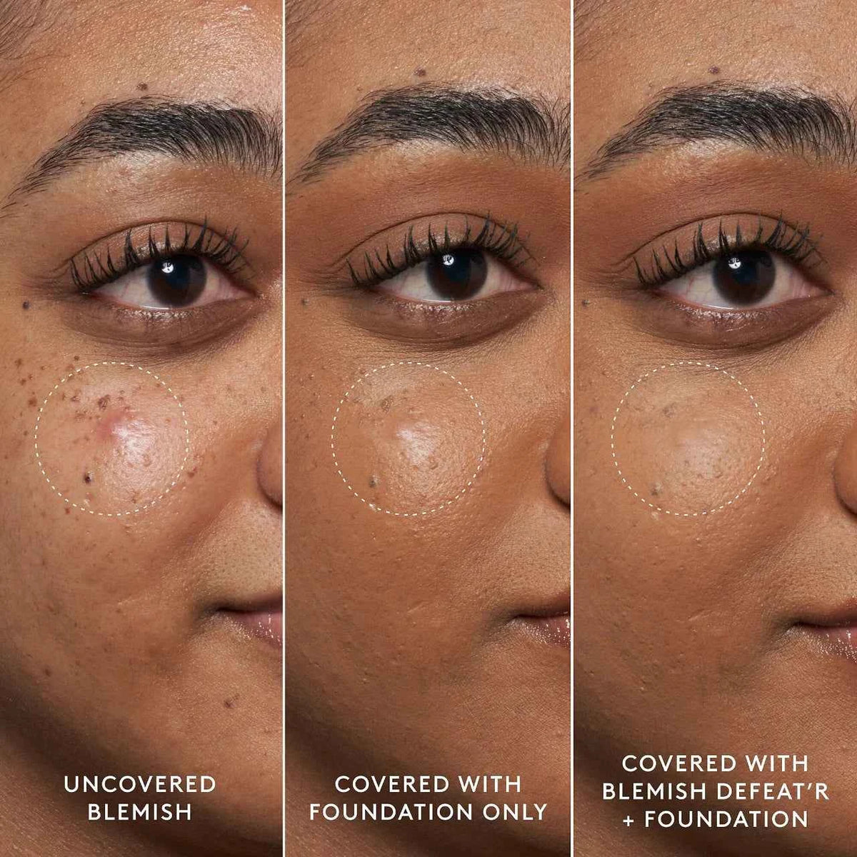 Blemish Defeat’r - Bha Spot-Targeting Gel