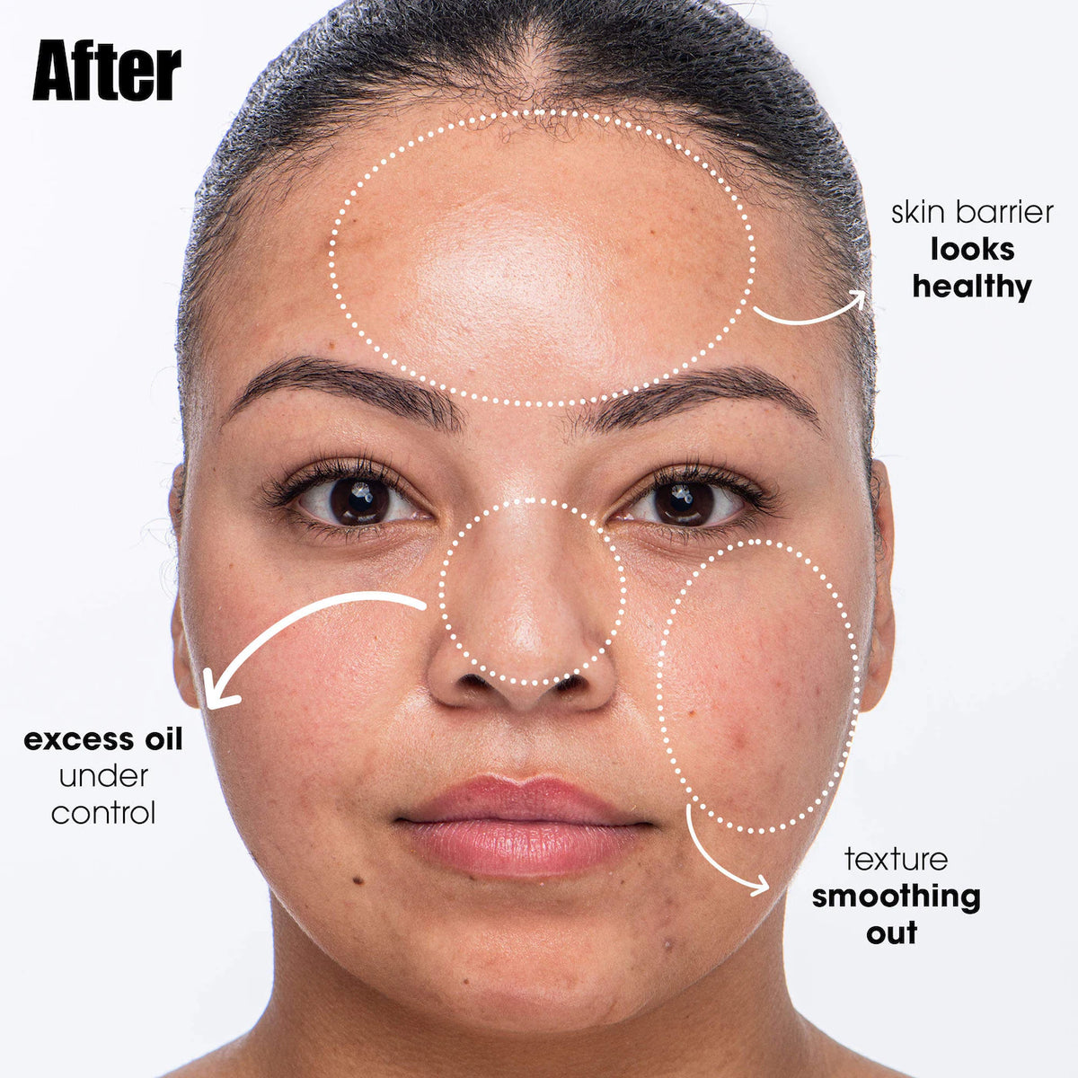 Breakout Breakup Salicylic Acid Cleanser - Azora Beauty