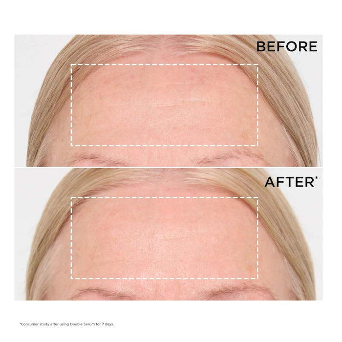 Double Serum