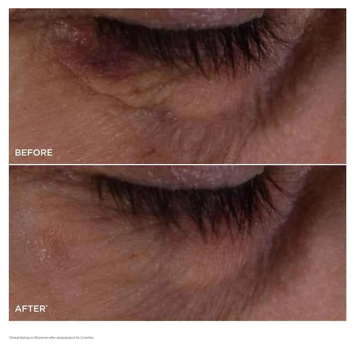 Double Serum Eye