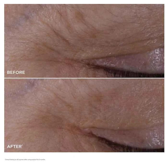 Double Serum Eye