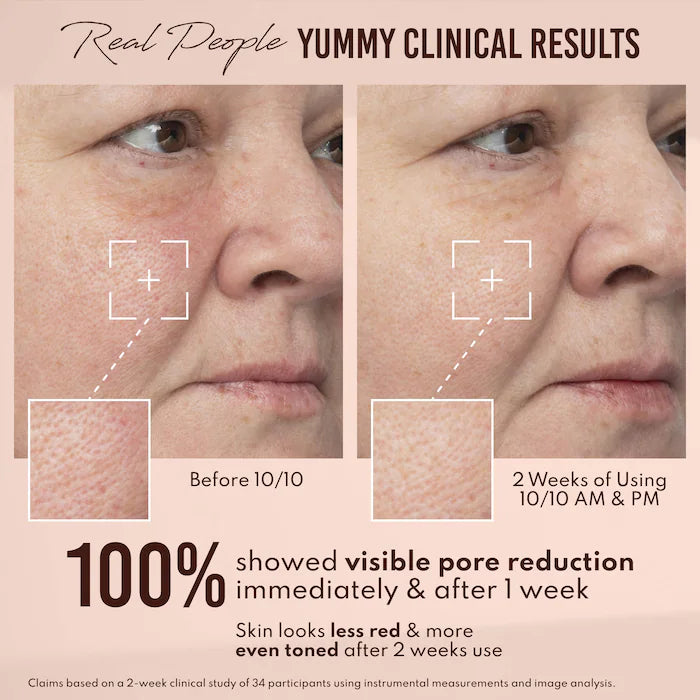 Yummy Skin 10/10 Barrier Boost Hyaluronic Acid + Ectoin Plumping Serum