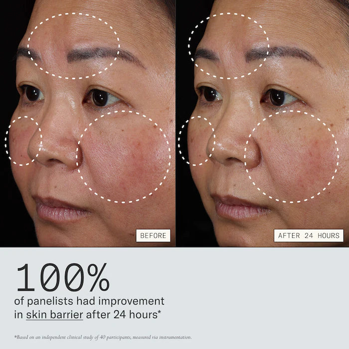 Instant Angel Lipid-Rich Firming Moisturizer