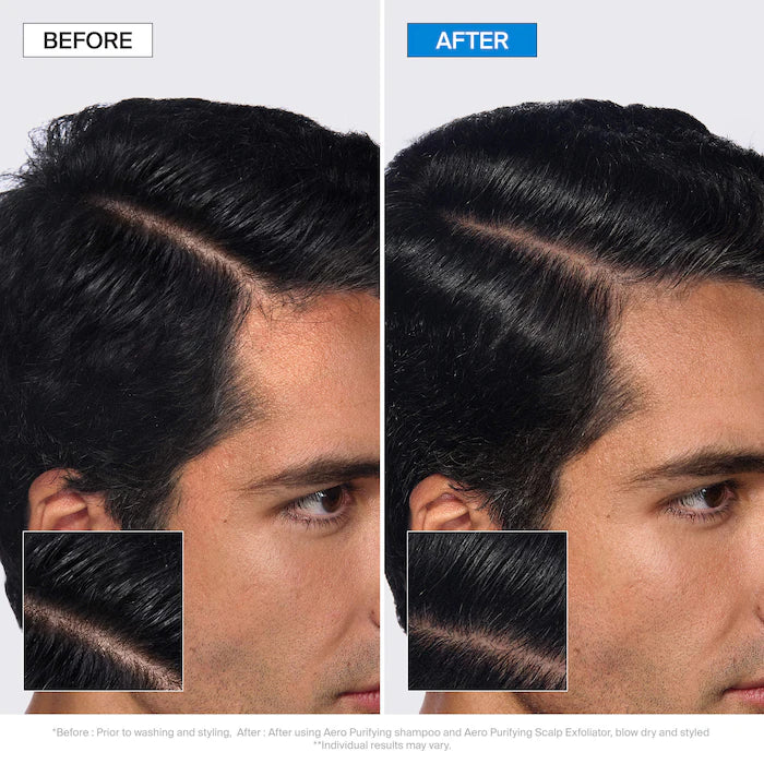 Aero Purifying Shampoo For Oily Hair & Buildup