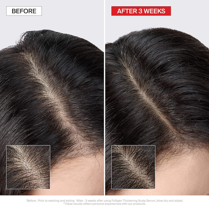 Folligen Thickening Scalp Serum For Thinning Hair