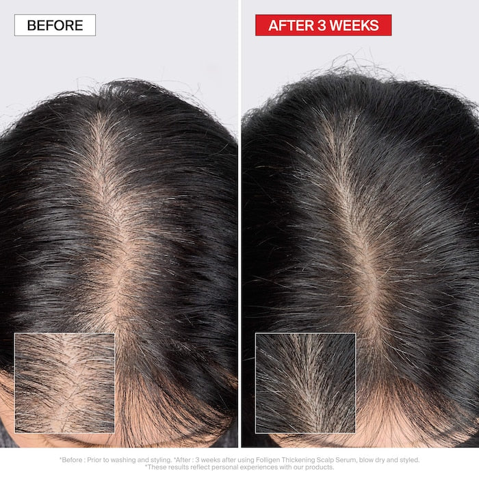 Folligen Thickening Scalp Serum For Thinning Hair