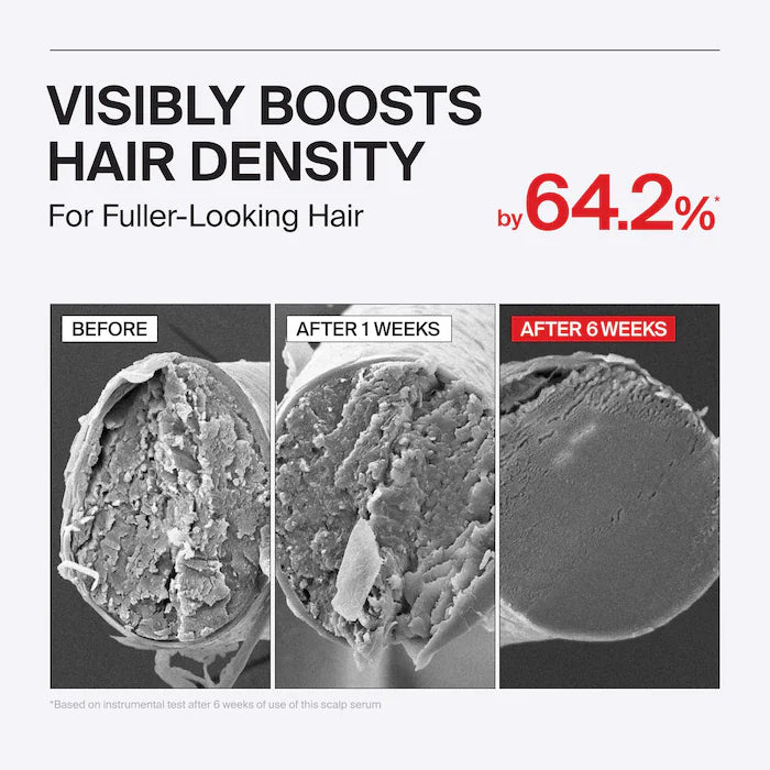 Folligen Thickening Scalp Serum For Thinning Hair