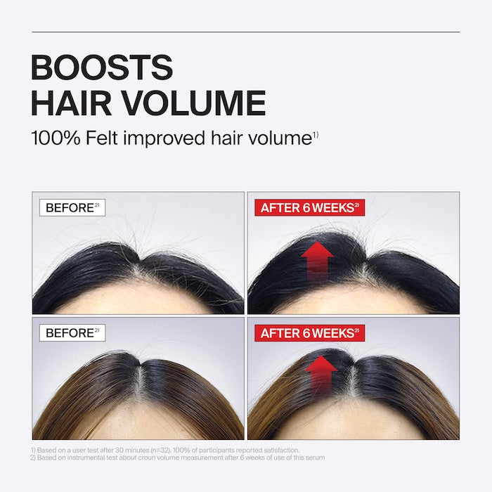 Folligen Thickening Scalp Serum For Thinning Hair
