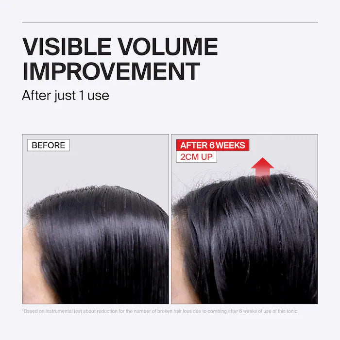 Folligen Thickening Scalp Tonic For Thinning Hair