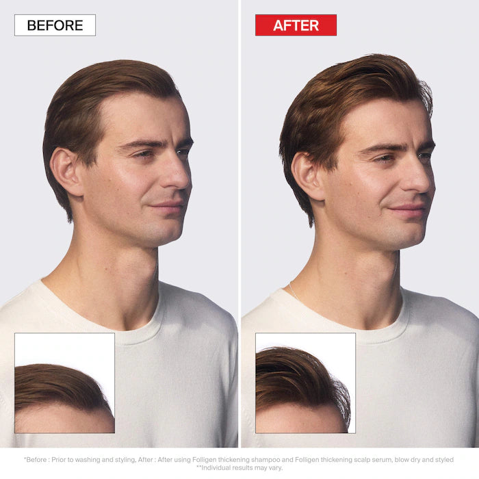 Folligen Thickening Shampoo For Thinning Hair