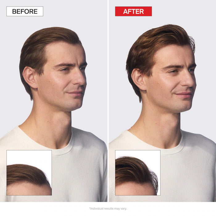 Mini Folligen Thickening Essentials Kit For Thinning Hair