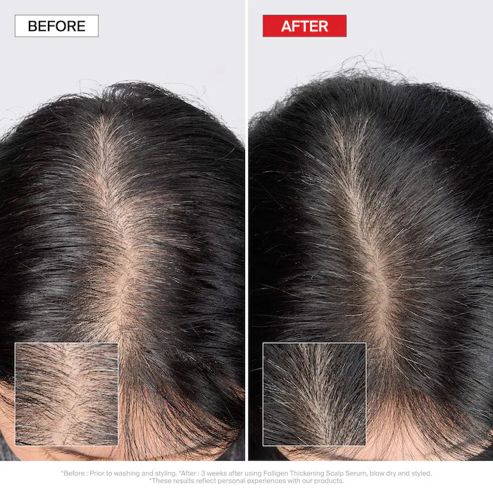 Mini Folligen Thickening Essentials Kit For Thinning Hair