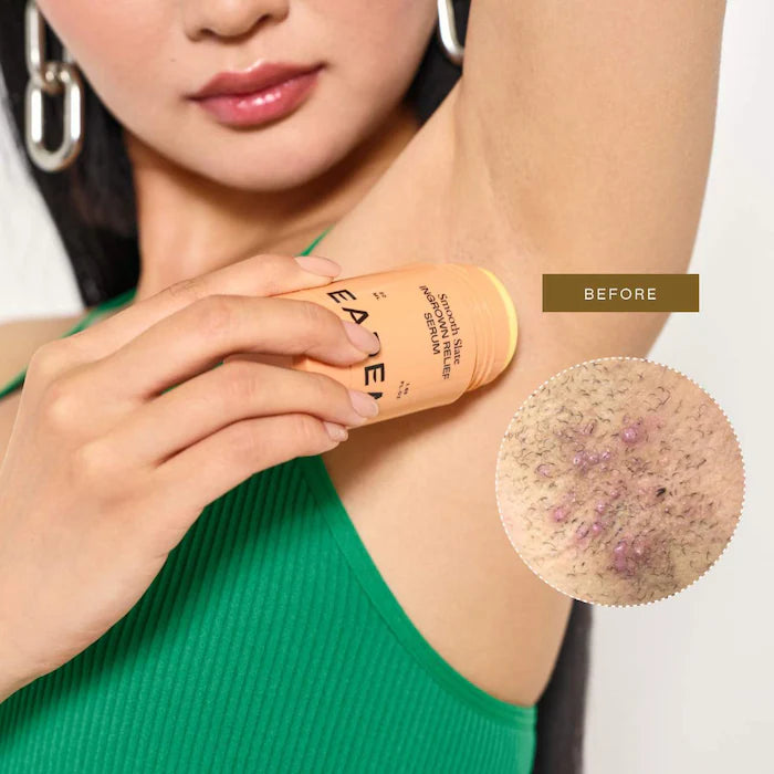 Smooth Slate Ingrown Hair + Dark Spot Serum