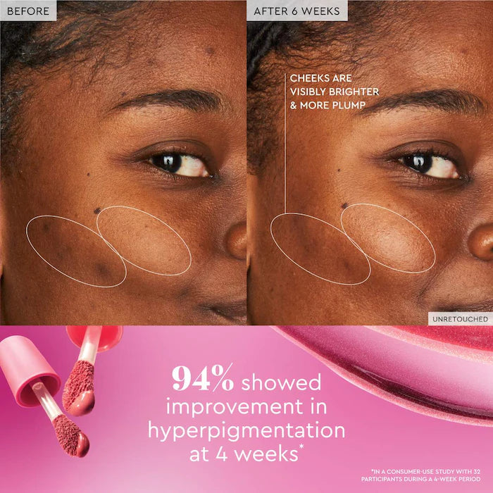 Watermelon Glow Niacinamide Dewy Flush - Azora Beauty
