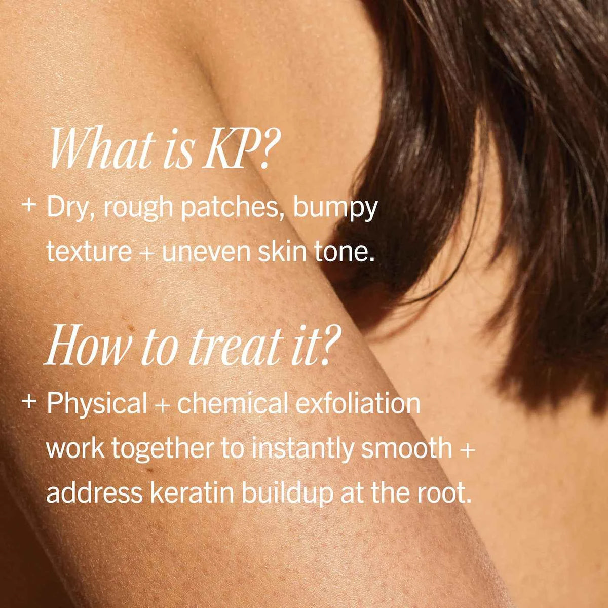 KP Bump Eraser Body Scrub with 10% AHA