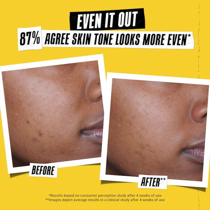 Better Screen™ UV Serum SPF 50+ Facial Sunscreen - Azora Beauty