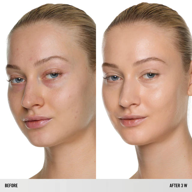 SurrealSkin™ Foundation - Azora Beauty