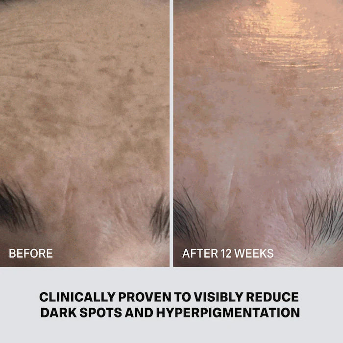 Molecular Hero Dark Spot Serum With Malassezin Vitamin C Alternative