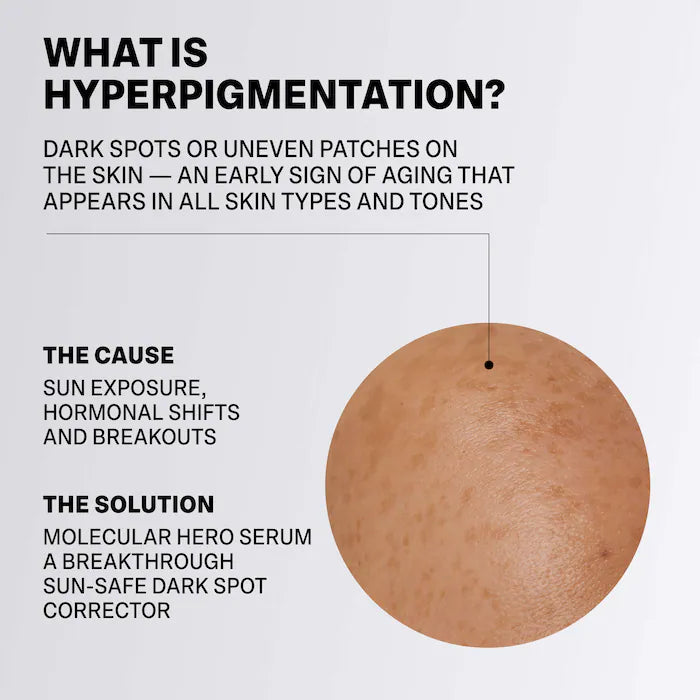 Molecular Hero Dark Spot Serum With Malassezin Vitamin C Alternative