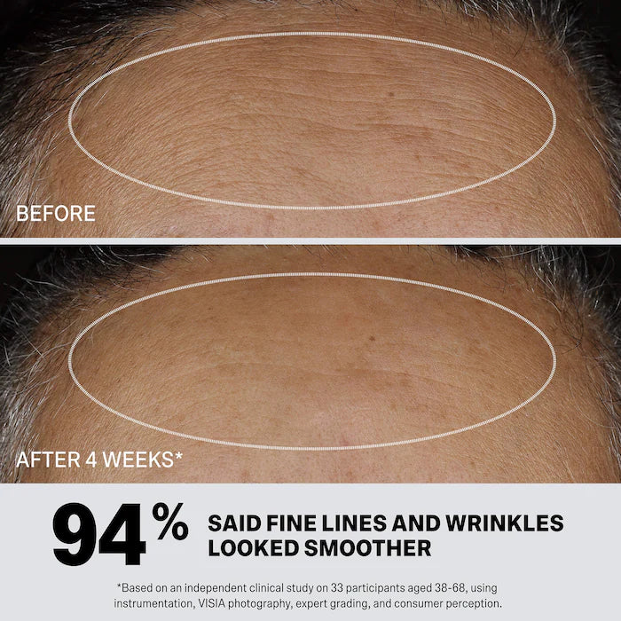 Retinol Synergist Anti-Aging Treatment Serum With Malassezin + 0.3% Encapsulated Retinol
