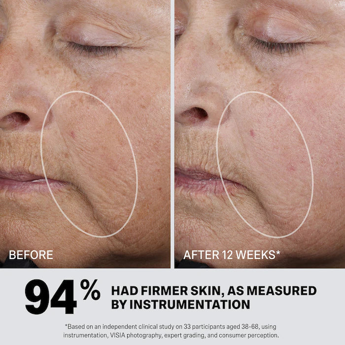 Retinol Synergist Anti-Aging Treatment Serum With Malassezin + 0.3% Encapsulated Retinol