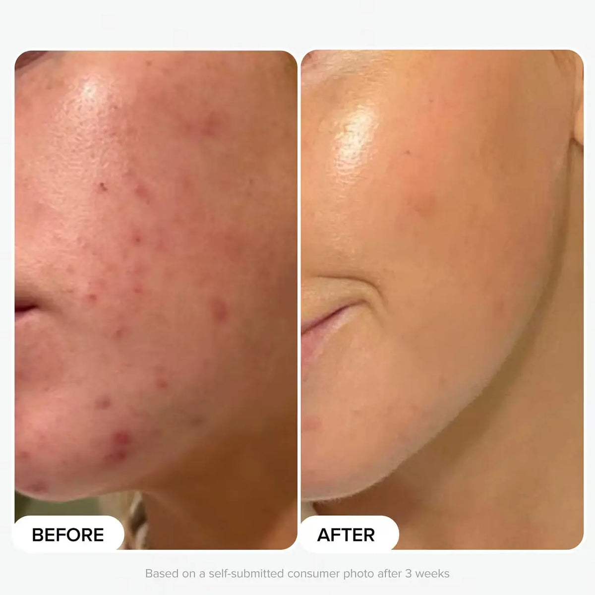 The Plump & Glow Kit - Azora Beauty