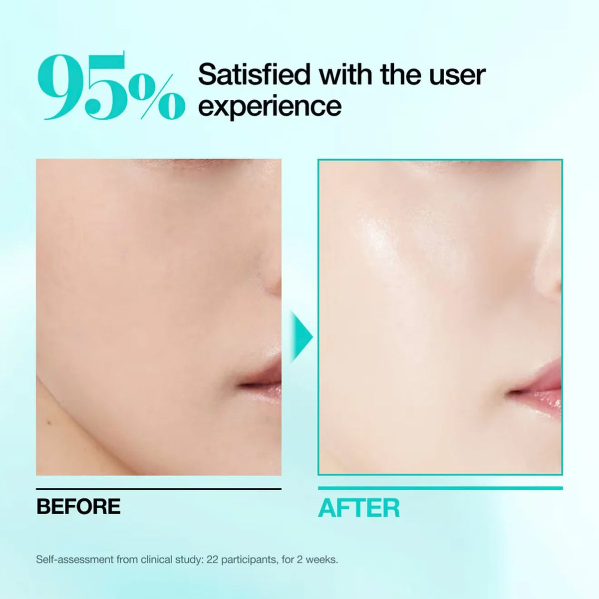 PDRN Hyaluronic Acid Capsule 100 Serum Mask - Azora Beauty