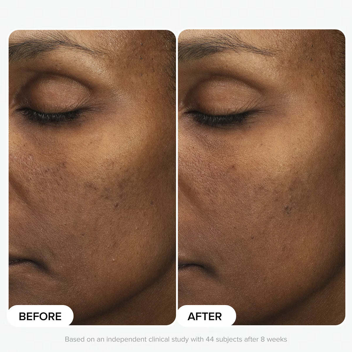 Multi-Level Exfoliation Trial Kit - Azora Beauty