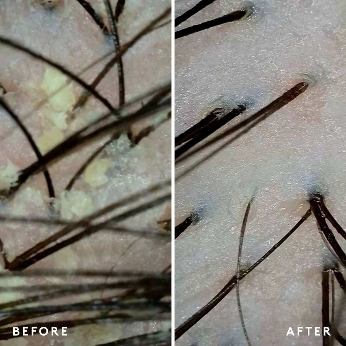 Scalp Remedy Shampoo - Azora Beauty