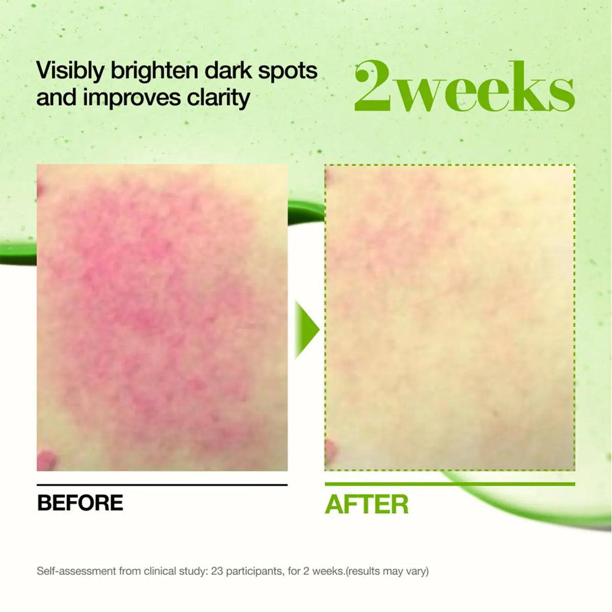 Mini for Blemish - Azora Beauty