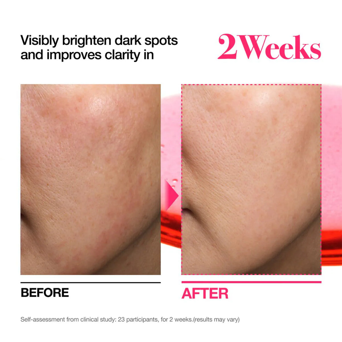 Mini for Dark Spot TXA4 - Azora Beauty