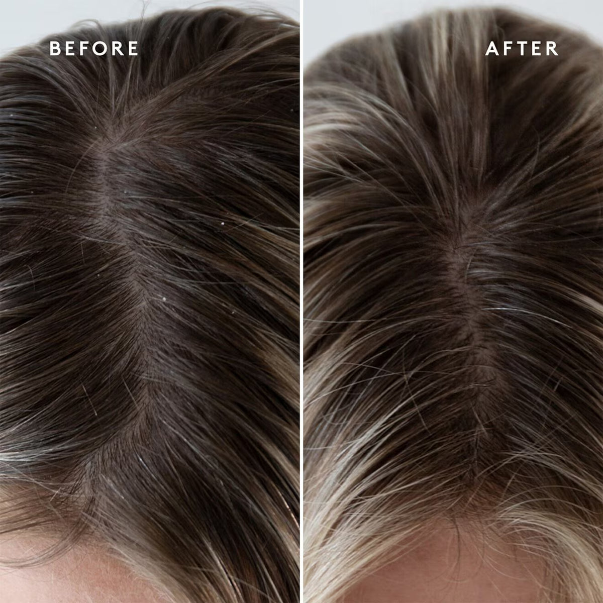Scalp Exfoliating Treatment - Azora Beauty