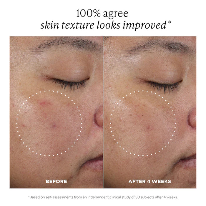 C15 Vitamin C Super Booster Serum For Brightening Dullness & Uneven Tone