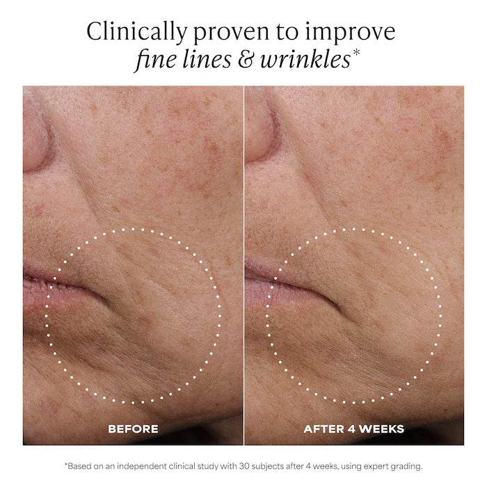 C15 Vitamin C Super Booster Serum For Brightening Dullness & Uneven Tone