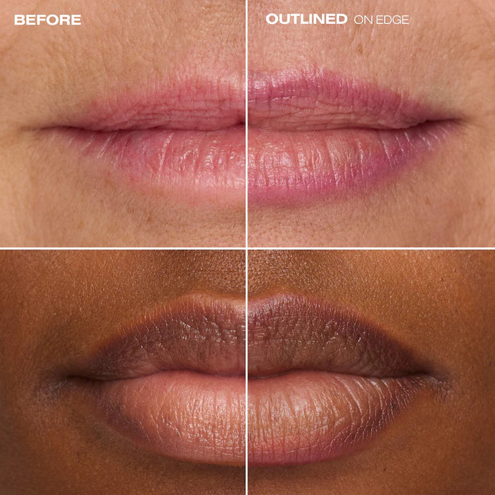 PHLip Liner® Personal Lip Contour