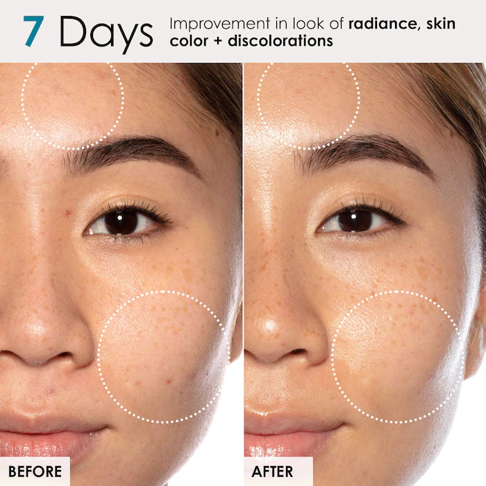 Good Genes All-In-One Lactic Acid Treatment