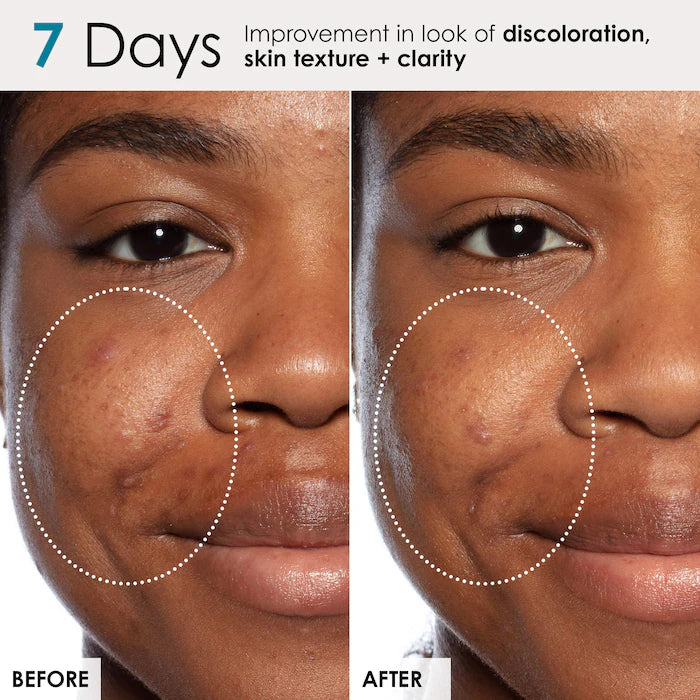 Good Genes All-In-One Lactic Acid Treatment