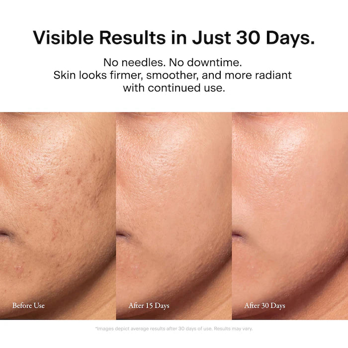 The Glow Signature Professional-Grade Ultrasound Skincare Device For Firming, Radiance & Anti-Aging
