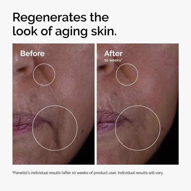 GF Solution 15% Serum