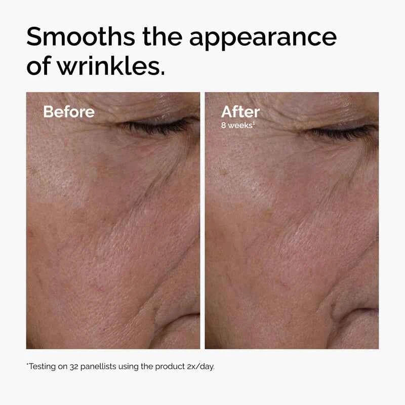 Multi-Peptide + HA Serum