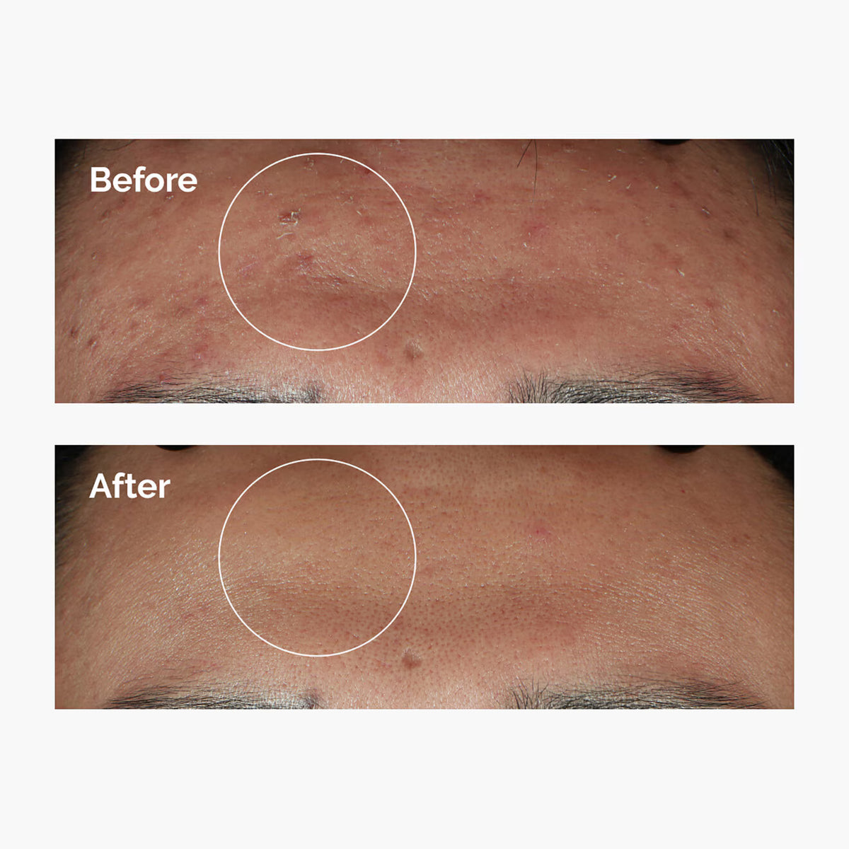 Niacinamide 10% + Zinc 1% - Azora Beauty