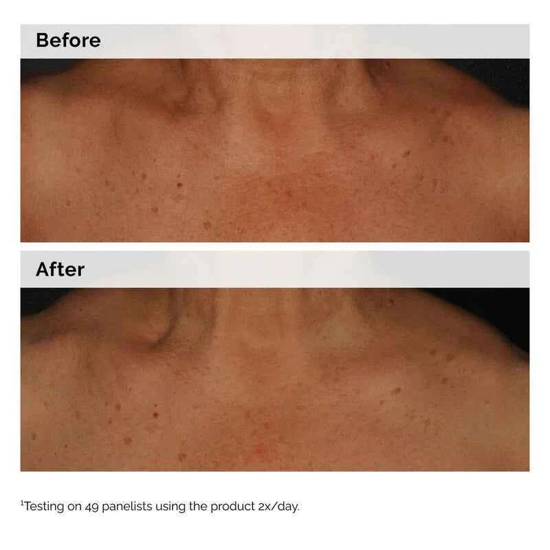 Niacinamide 5% Face & Body Emulsion