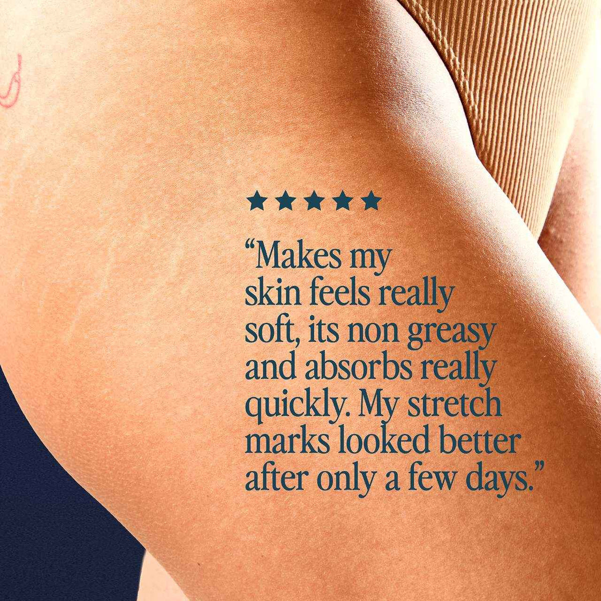 The Skin Support Oil For Stretch Marks